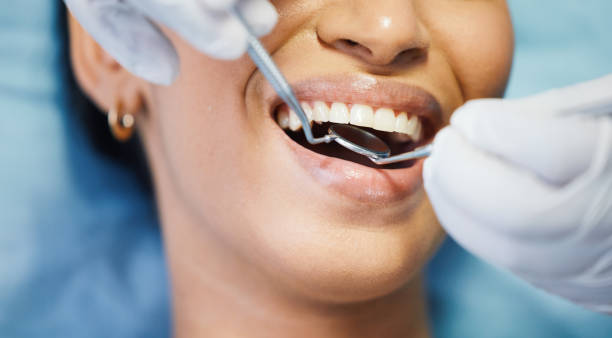 Best Emergency Tooth Extraction in Stillwater, OK